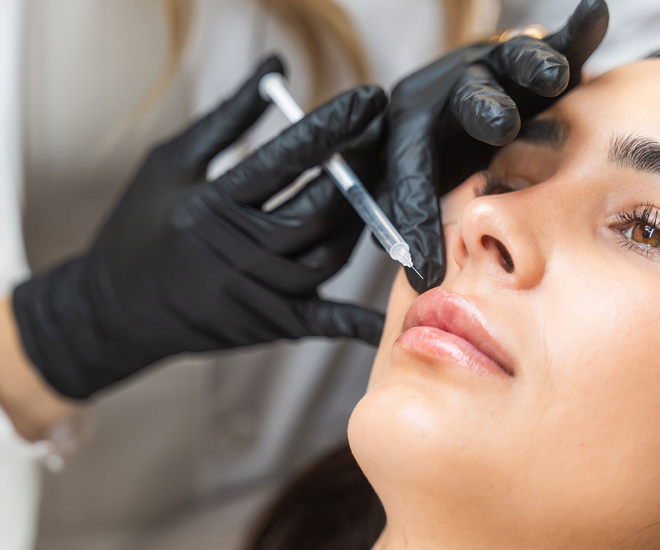 Dermal Fillers at Opal Aesthetics in Bakersfield