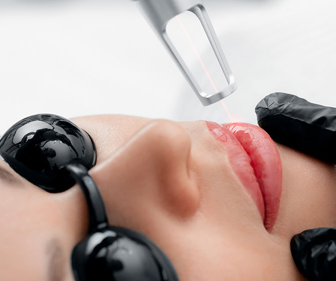 Laser Treatments treatment at Opal Aesthetics